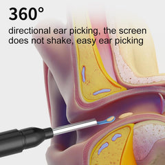 The EarEase™ Wax Remover – Safe & Painless Ear Cleaning Tool with HD Camera